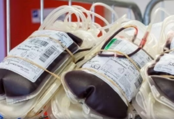 Kreu trasfuzion gjaku te Dëshmimtarja e Jehovait, kirurgu rrezikon denoncimin