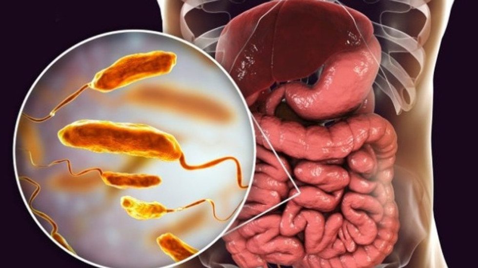 Alarm nga vdekja e pensionistit, kolera rikthehet në Britani pas 125 vitesh