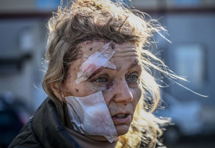 "Fytyra e parë e luftës" kthehet në Ukrainë dhe sfidon Putinin: Po ke guxim eja përballu!