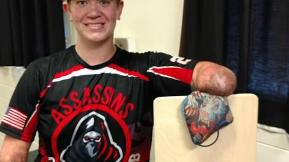 Arrestohet vrasësi pa duar dhe pa këmbë